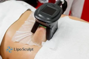 Are The Results From Aqualyx Permanent? 4 Compare Aqualyx Stoulton to other fat reduction treatments.