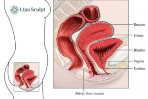 Treatment For A Leaky Bladder 2 How EM Chair treatment Stoulton can help Leaky bladder issues. Read more now!