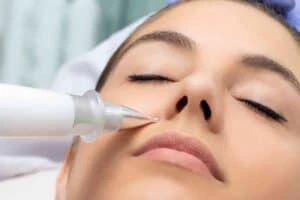 Best Actinic Keratoses Removal 3 Actinic keratoses Stoulton solutions - book in today!