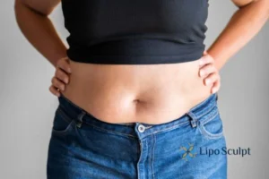 Bidding Farewell to Muffin Tops with Aqualyx Fat Injections 2 Do you wish you could reduce your muffin top Stoulton With Aqualy fat dissolving injections you can!